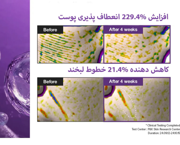 اسنس نامبوزین